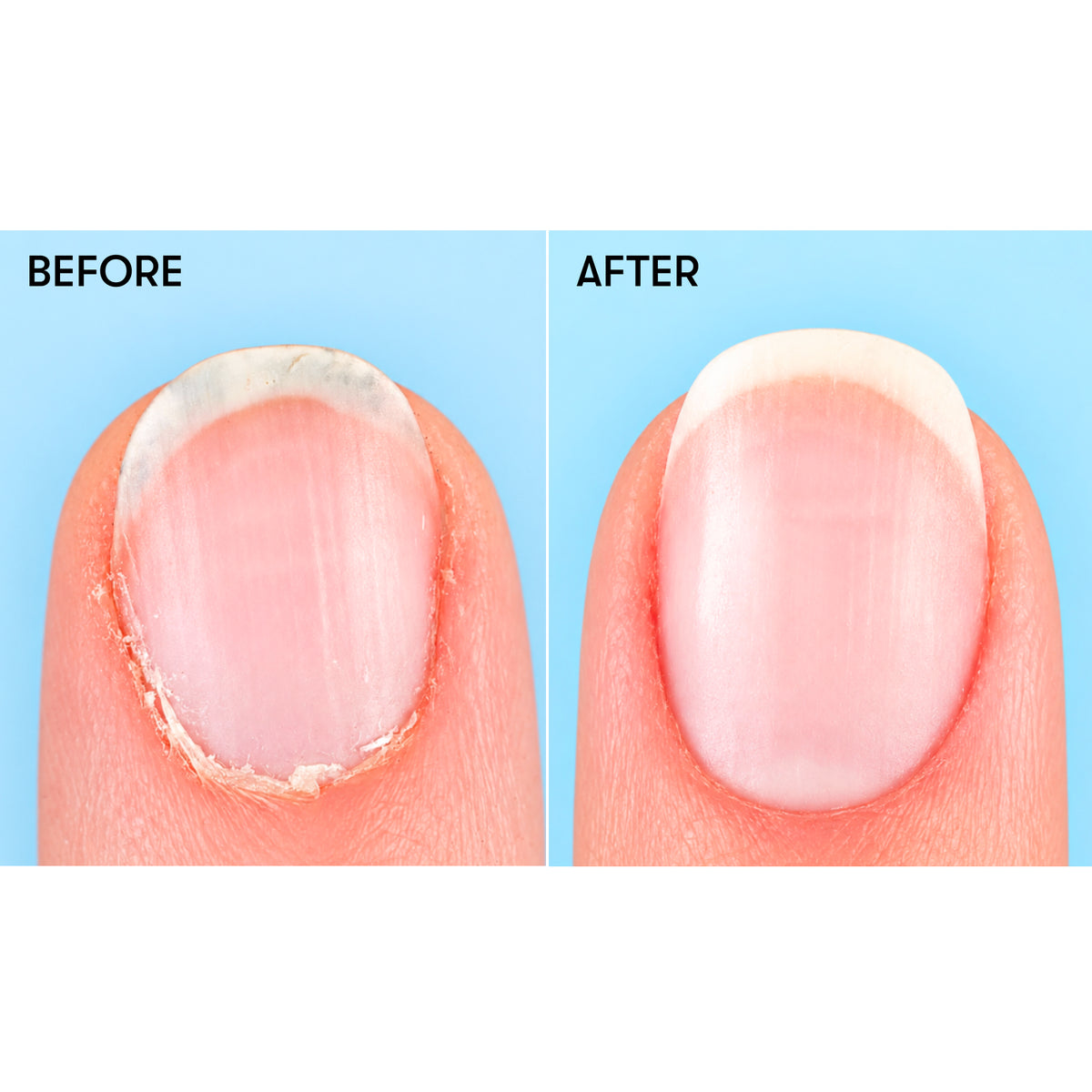 Bye Bye Cuticles Blueberry Cuticle Remover Serum